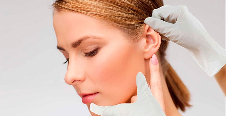 Otoplasty : Ear plastic surgery