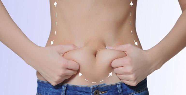 Abdominoplasty surgery