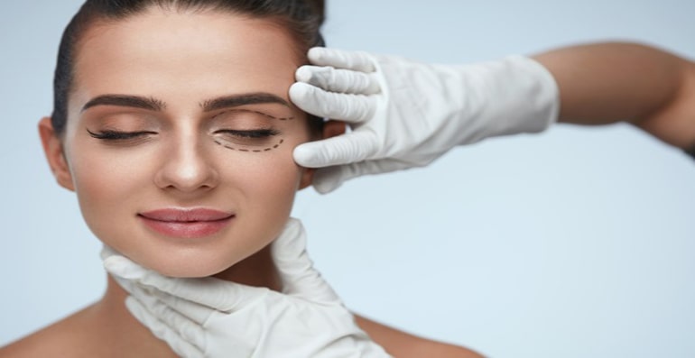 Blepharoplasty