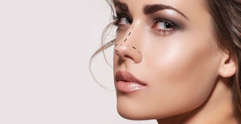 Rhinoplasty : Nose cosmetic surgery