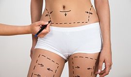 Cosmetic surgery and treatments